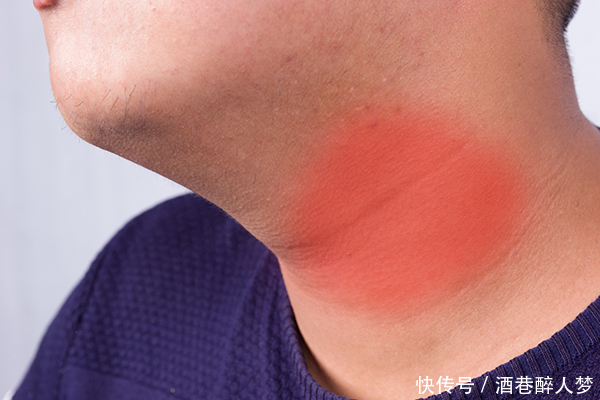 癌症|化疗有什么用得了癌症就一定要化疗