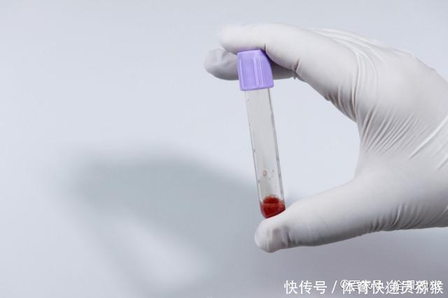  希望|高血脂多半“偏爱”5类人，希望你不在列，喝2水，保持血管年轻态