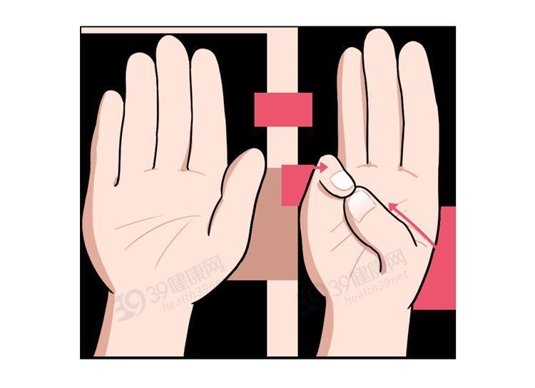 折磨|常年折磨女性的腱鞘炎，是怎么产生的？如何治疗？告诉你详细方法