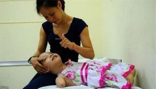 医生|孕检发现孩子没有手脚,妈妈却坚持和医生说“生”,如今活成公主