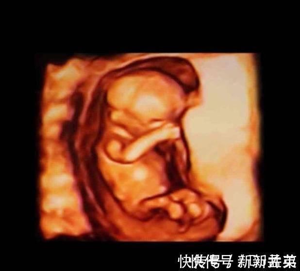 羊水|胎儿从卵泡到性别形成,17张图片清晰诠释,男宝女宝看得很清楚