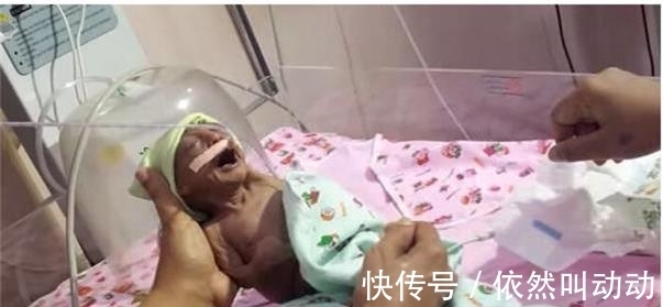 褶皱|母亲生下宝宝，奇丑无比狠心抛弃，爷爷喂奶抚养长大创造奇迹！