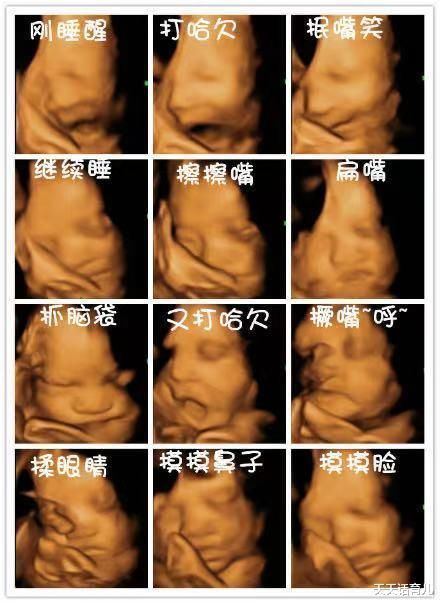 家属|为何有的医院做四维彩超不让家属陪?3大原因,孕妇有权知道