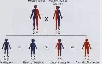 携带者|家有肌营养不良患者不必惊慌!