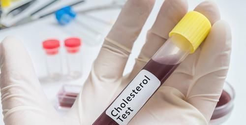 好习惯|70岁老人,甘油三酯从8.3降到1.7,只因他坚持3个好习惯