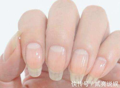 阳气不足|指甲上的“月牙”越多越好有些人可能搞错了,最好了解一下