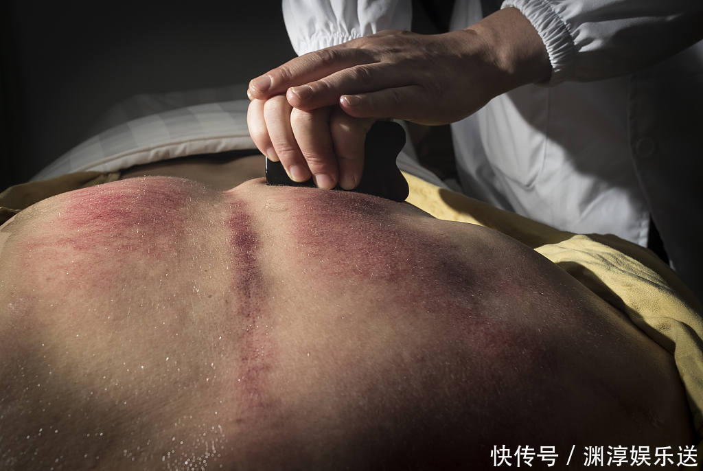 百治不如一刮!10种刮痧法,刮走全身疾病,用勺子就能做!不看真亏!