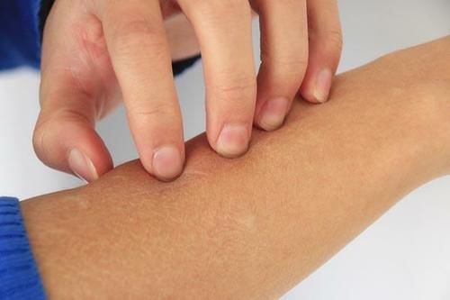 骨质疏松|女性黄体酮不足,身体会露出哪些“丑态”?占得多了,要及时调理