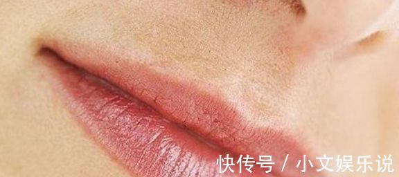 妇科疾病|女人这个部位突然长毛,或许是有妇科疾病的表现