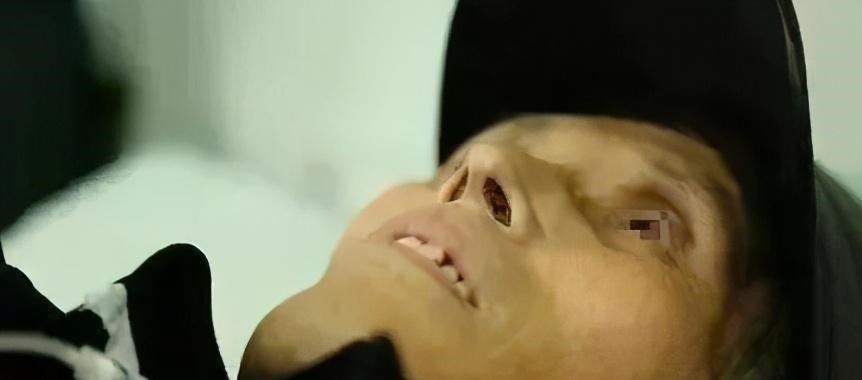 胃病|60岁男子,腹痛入院,查出胃癌,提醒这东西真不能总吃