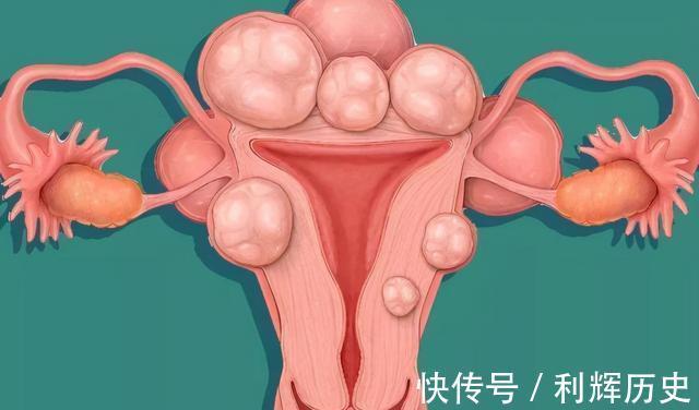 含漱液|几块钱一瓶的“甲硝唑”,原来还有这些妙用,别白白错过了