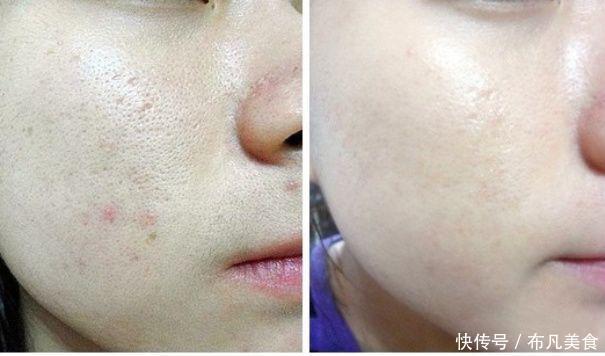 这些医美项目比你们所有的化妆品还有用!