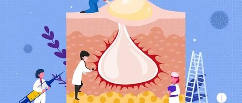 肿瘤患者|为何腹泻偏爱肿瘤患者?这五种原因在作怪