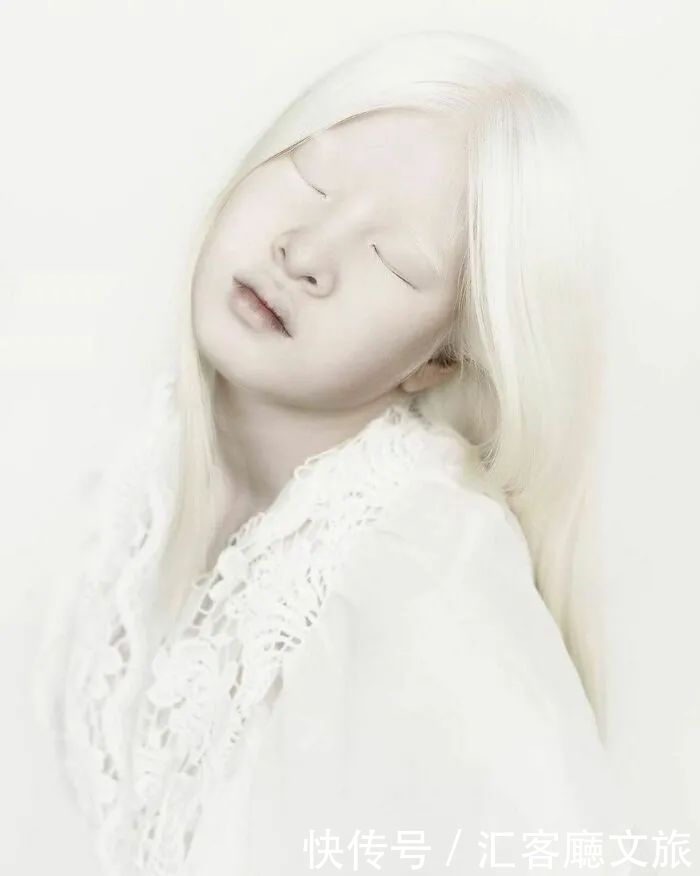 逆袭|因“全身雪白”被遗弃的中国女孩,逆袭成超模的故事让人泪目
