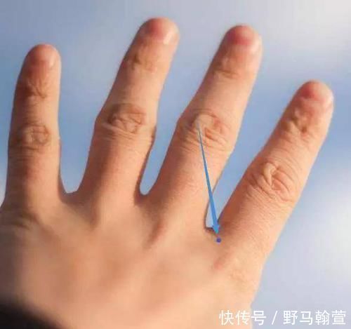 头疼|手上有四个穴位,可疗一切头疼,一起来了解一下吧