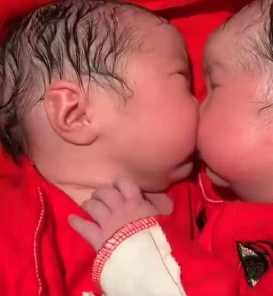 心灵感应|双胞胎姐妹出生20分钟后,姐姐对妹妹的行为,让护士泪目了