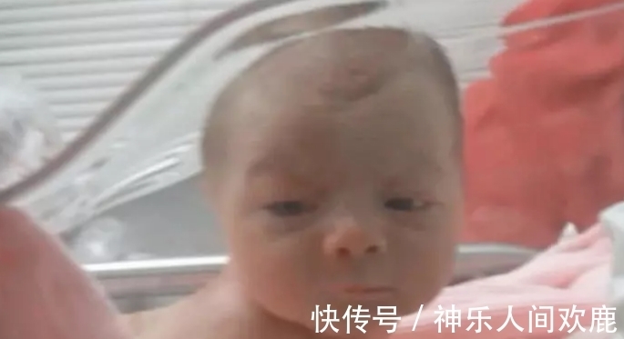 闪光灯|刚出生两天的婴儿听到妈妈的声音,居然抬头看妈妈,医生都看愣了