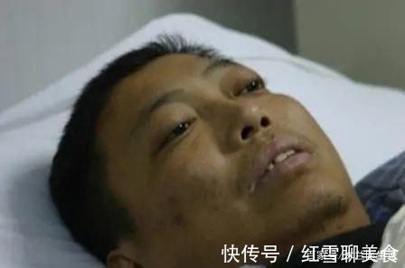 血糖|45岁男子糖尿病入院，肾衰去世，医生：1事放纵，血糖易“飙升”