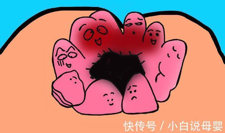 疼痛|痔疮终于遇上“死对头”了,肛肠科大夫每天都在坚持吃它!