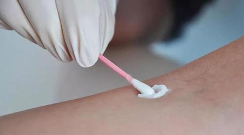 想染发又怕伤头发，育发顾问教你怎么做？