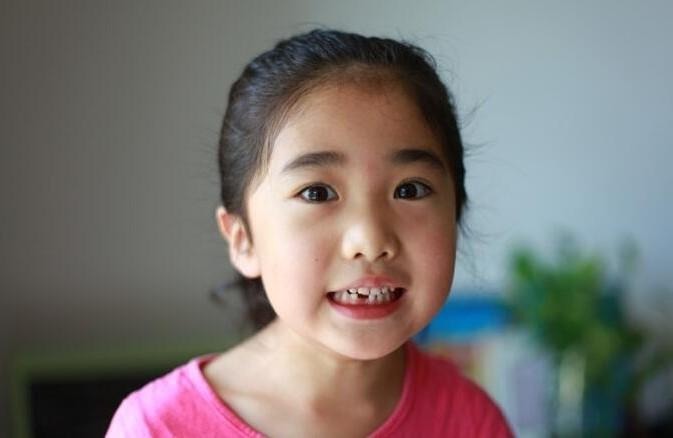 钱包君|宝宝乳牙掉了不要扔,重要时刻能救命现在流行的存乳牙真靠谱吗