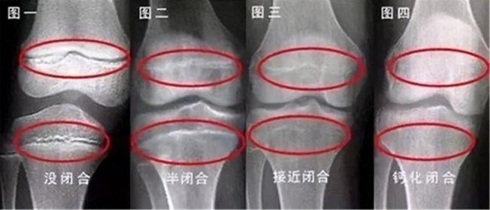 特征|当男孩出现这些特征,暗示到了长高“天花板”,和年龄关系不大