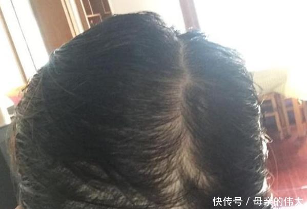 刘医师|女人“衰老”的3个表现，若你1个也没有，恭喜你还年轻呢！