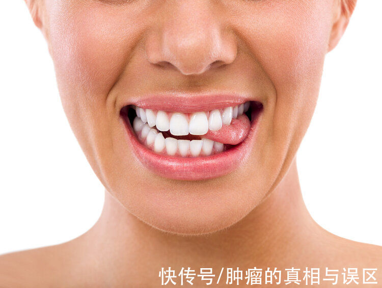 蛀牙|口腔溃疡也会癌变?医生提醒:符合2个特点的口腔溃疡需格外注意