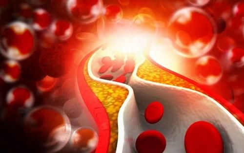 饮食习惯|医生直言:3种“家常菜”,可比肥肉还伤血管,高血脂人群要绕道