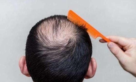 肾功能|男性开始衰老的4个丑态,若占3个以上,或许你是老了,别不服气!