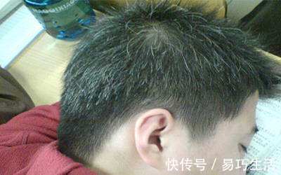 食物|头发白发，有可能是缺乏营养，3种食物帮助恢复，吃一种也好