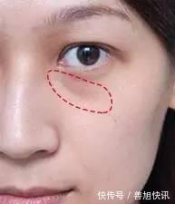 血糖|血糖高不高,只需看身体的4个地方,若无异常,离糖尿病还很远