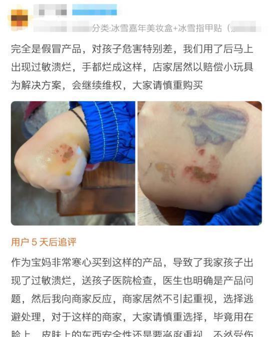 家人|送礼物毁了孩子一张脸!家人反目:你怎么敢给孩子送这个?