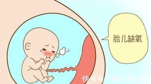 新生儿脑瘫|新生儿脑瘫的罪魁祸首是胎儿缺氧，如何对胎儿缺氧进行监护？