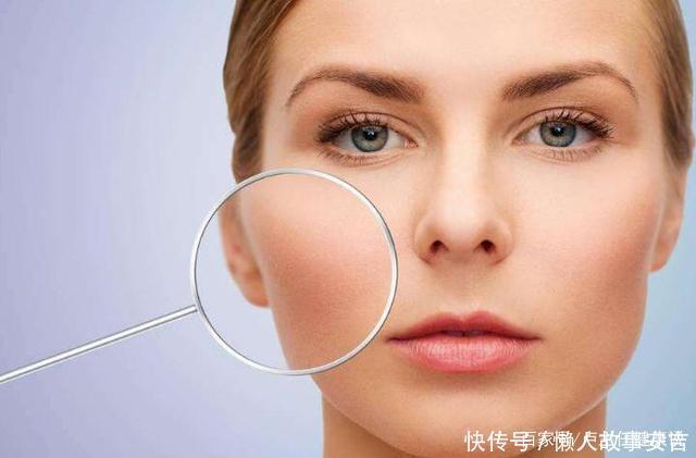 皮肤科主任:这5种女人容易长斑,日常多吃1物,淡斑美白