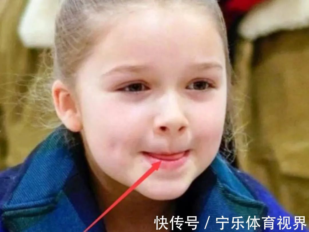 不良习惯|孩子嘴唇干裂、起皮还出血怎么办?医生教你正确护理,比喝水管用