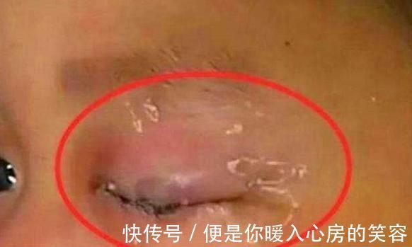 医生|3岁女宝误将502滴入眼睛,宝妈临危不乱的做法,获医生夸赞