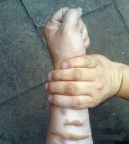 穴位|人体上居然还有“一键关机、一键清理”穴位,收藏以备不时之需!