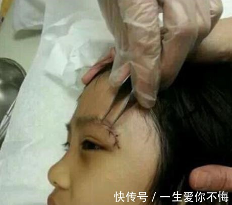 永久性|录《爸爸去哪儿》造成眼角永久性伤害,13岁费曼露无刘海正脸!