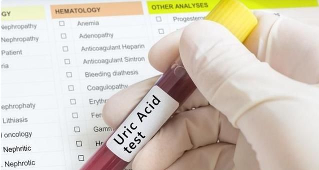  降血糖|一种“零食”天天吃，胜过降糖水，主任：若坚持，高血糖不再来