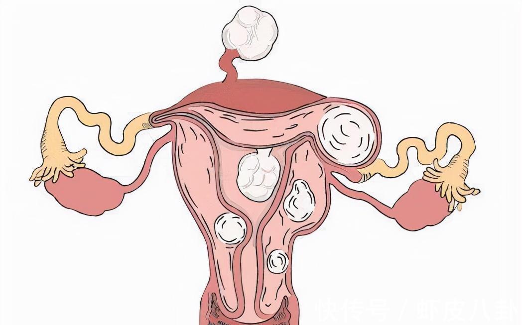 奶酪|绝经并非全是坏事,绝经后这些问题或会离你而去,偷着乐吧