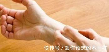 皮肤瘙痒|医生:有没有糖尿病,4个小地方或许就能确认!不妨自测一下