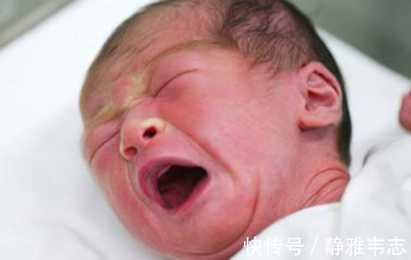 宝宝这四个地方越丑,以后可能越好看,你家宝宝占几个