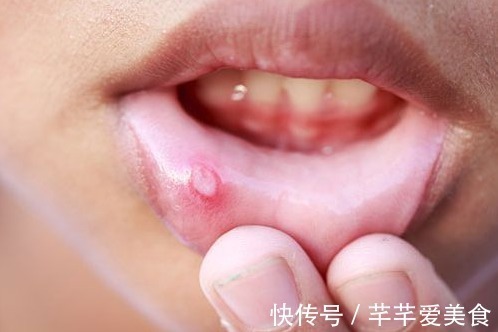 局部|以下5种症状不断发生,十有八九就是癌,最好去检查一下