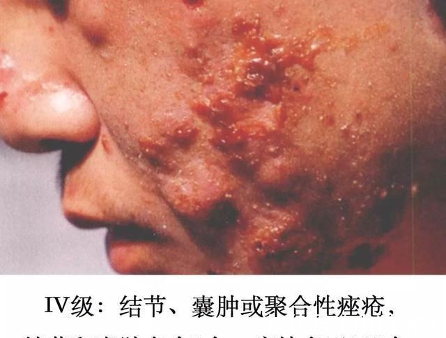 护肤品 哪些皮肤问题是护肤品不能解决的!