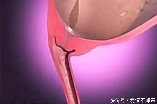 生娃|宝宝那么大，如何从狭小产道出来？了解后方知母爱多伟大！