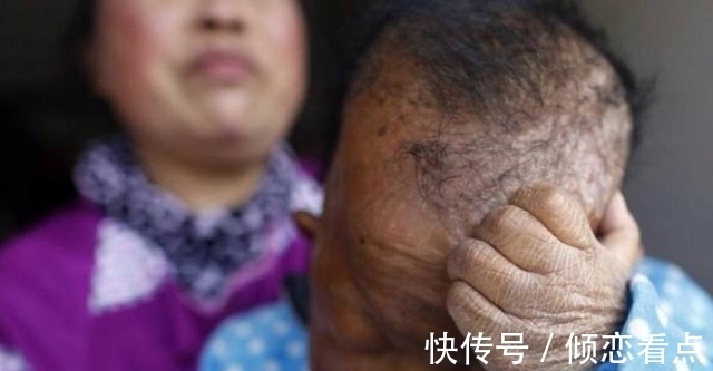 智力障碍|身体像3岁大婴儿却已活了30年,从未叫过一声妈,真相让人落泪