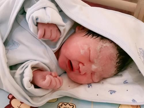 嫌弃|“黑脸宝宝”被亲妈嫌弃，护士却夸好看，2个月后高颜值逆袭