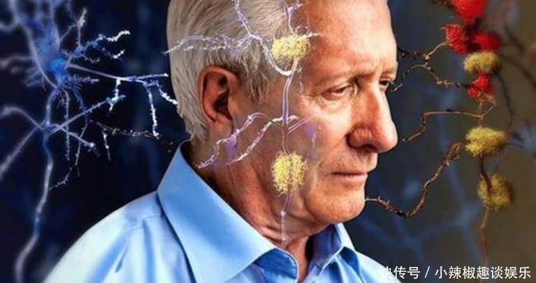 千万别|脑梗发作前,身体会发出4个“求救信号”,千万别自己硬抗