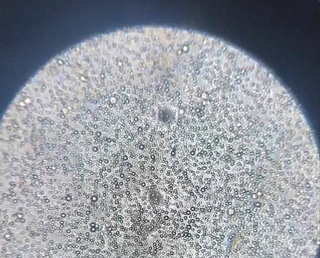 母乳|显微镜把“母乳”放大1000倍,样子令网友惊叹母爱太神奇